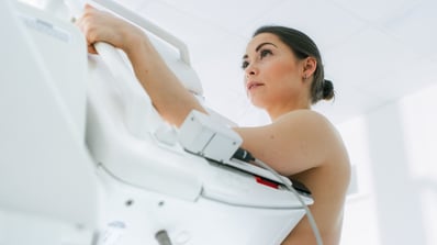 what to expect from a 3d mammogram
