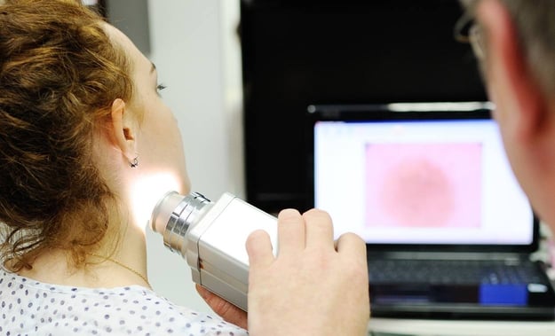 Staging Melanoma skin cancer - wvci
