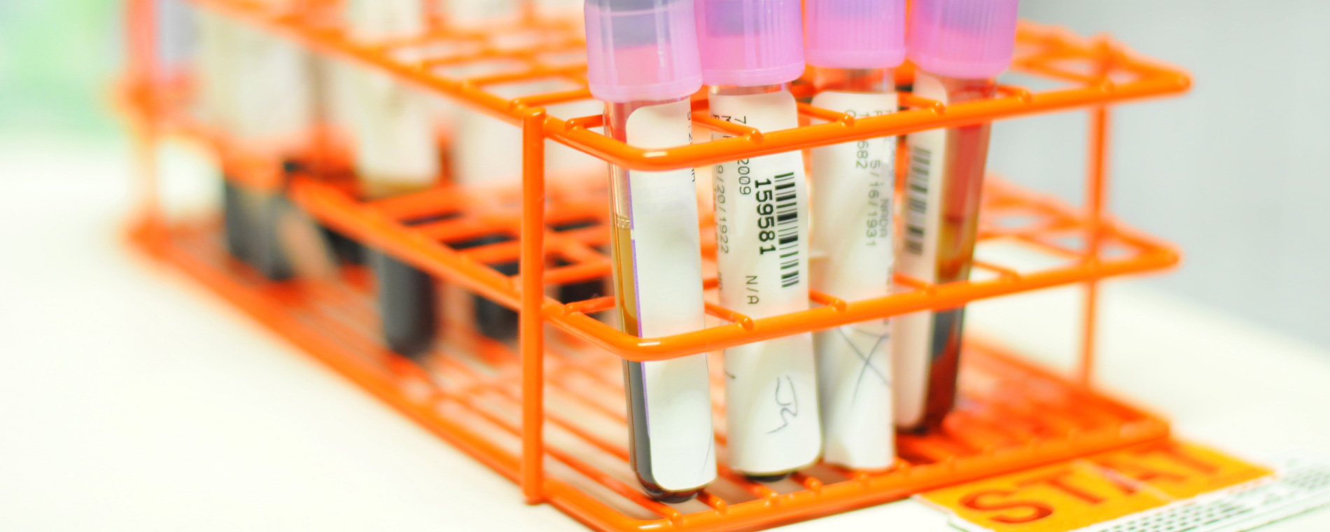 WVCI Cancer Clinic Laboratory