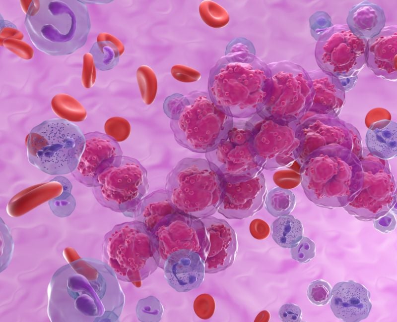 leukemia-cancer-cells-blood-cancer