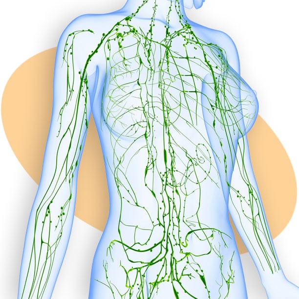 lymphoma-diagram