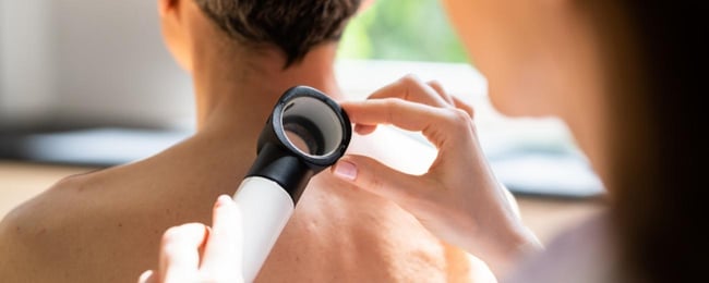 treating melanoma skin cancer at willamette valley - wvci