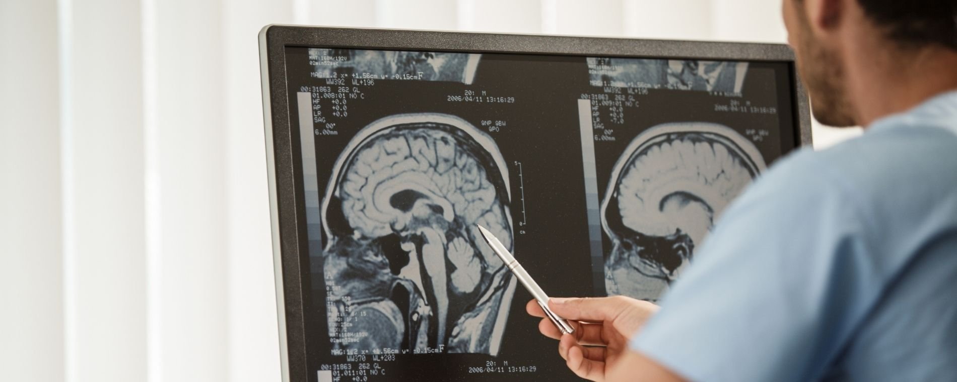 wvci brain tumors and spinal tumors - Central Nervous System Tumors