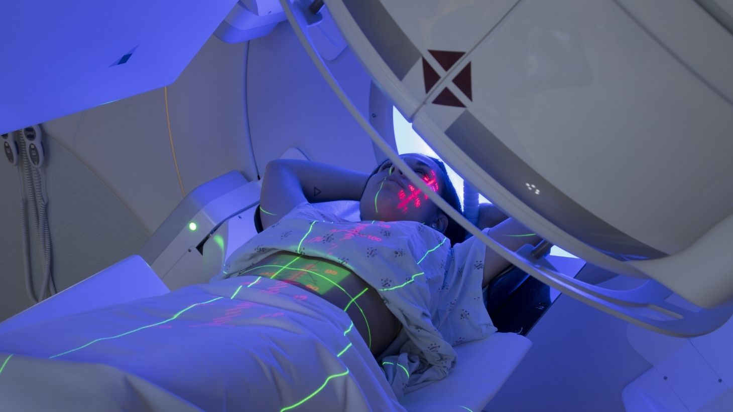 Using the Deep Inspiration Breath Hold Technique for Radiation Therapy Patients